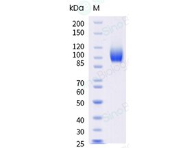 Sino Biological recombinant human EGFR His-tag protein 10001-H08H