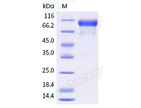 Sino Biological recombinant human HER2 ERBB2 His-tag protein 10004-H08H