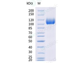 Sino Biological recombinant human ACE2 His-tag protein 10108-H08H
