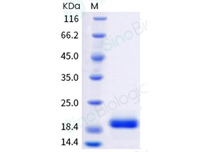 Sino Biological recombinant human IL-6 protein 10395-HNAE