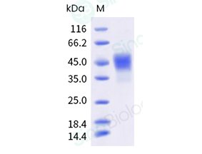 Sino Biological recombinant human TROP-2 His-tag protein 10428-H08H