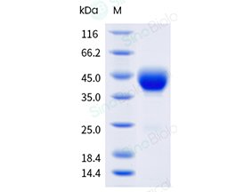 Sino Biological recombinant human CD38 His-tag protein 10818-H08H