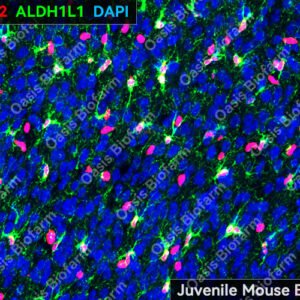Oasis Biofarm Olig2 Rabbit Polyclonal Antibody OB-PRB047