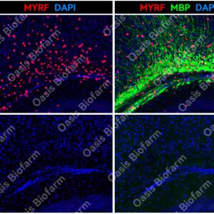 Oasis Biofarm MYRF Rabbit Polyclonal Antibody OB-PRB007