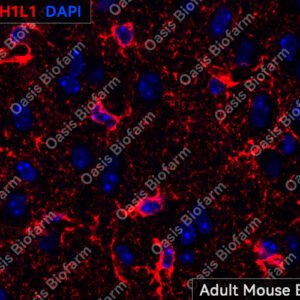 Oasis Biofarm ALDH1L1 Rabbit Polyclonal Antibody OB-PRB001