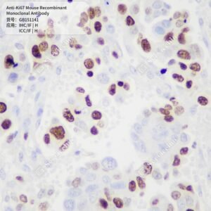 Servicebio Ki67 recombinant monoclonal antibody GB151141 clone SB42