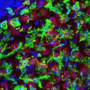 Novus Biologicals AIF-1 Iba1 Antibody NB100-1028
