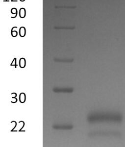 Novoprotein Recombinant Human VEGF165 protein C083