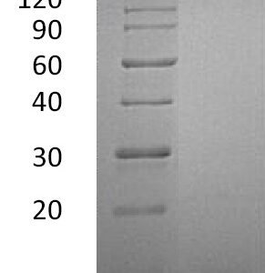 Novoprotein Recombinant Human IL-2 protein C013