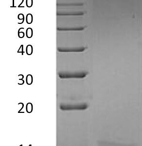 Novoprotein Recombinant Human IL-15 protein C016