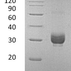 Novoprotein Recombinant Mouse Noggin C028 for organoid culture