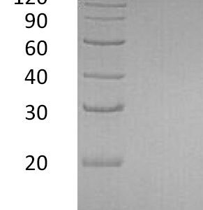 Novoprotein Recombinant Human EGF protein C029