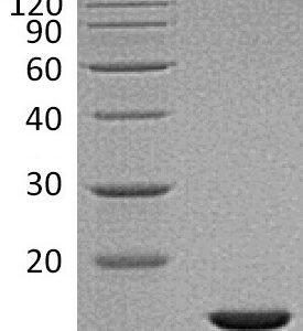 Novoprotein Recombinant Human FGF Basic FGF2 C046