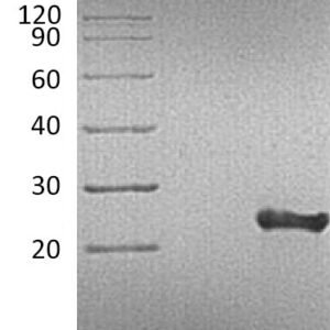Novoprotein Recombinant Human TNF-alpha protein C008