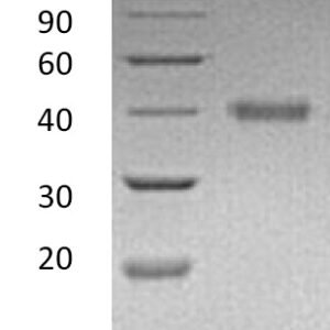 Novoprotein Recombinant Human R-Spondin 1 CX83
