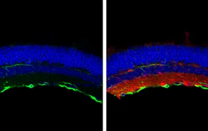 GeneTex GFAP rabbit polyclonal antibody GTX108711