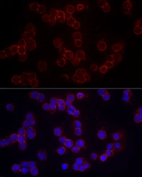 GeneTex CD86 rabbit polyclonal antibody GTX32507