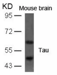 GeneTex Tau rabbit polyclonal antibody GTX50445