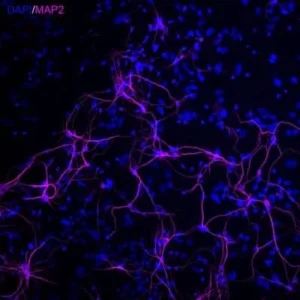 Novus Biologicals MAP2 Antibody NB300-213