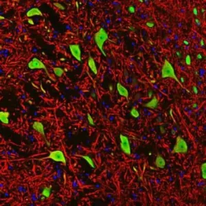 Novus RBFOX3 NeuN Antibody clone 1B7 NBP1-92693