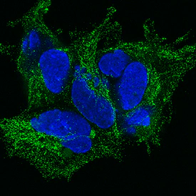 R&D Systems TGF-beta 1 monoclonal antibody MAB240