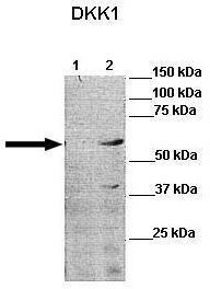 OriGene DKK1 Rabbit Polyclonal Antibody TA346496