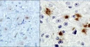 Novus Beta Amyloid Antibody clone MOAB-2 NBP2-13075