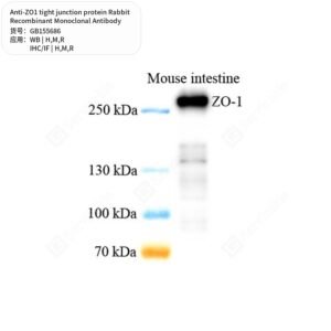 Servicebio ZO1 TJP1 rabbit recombinant monoclonal antibody GB155686