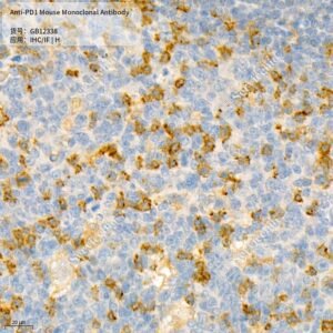 Servicebio PD1 mouse monoclonal antibody GB12338