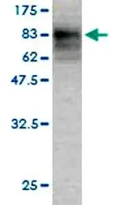 Novus p62 SQSTM1 Antibody clone 2C11 H00008878-M01