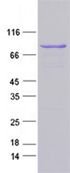 OriGene Tn5 Transposase Recombinant Protein TP750177
